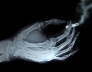 Бороться с курением будет Конь Долбак