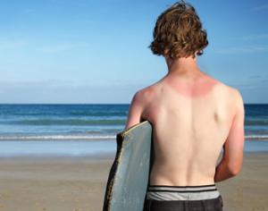 Биологи поняли, что такое солнечный ожог